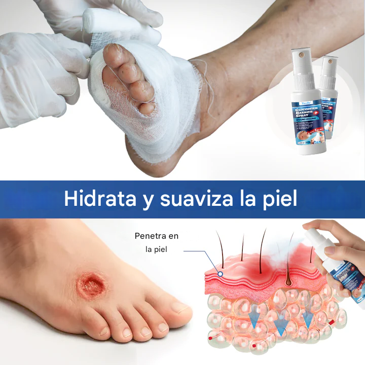 GlucoDerm Spray de barrera