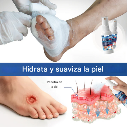 GlucoDerm Spray de barrera