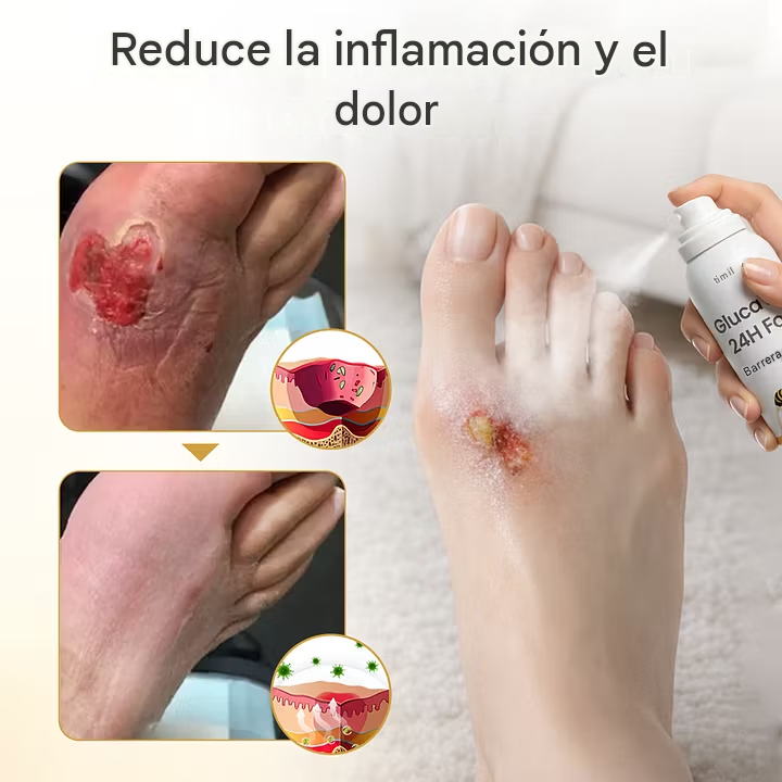 GlucaVeil Spray Barrera para Pies 24H 🔥