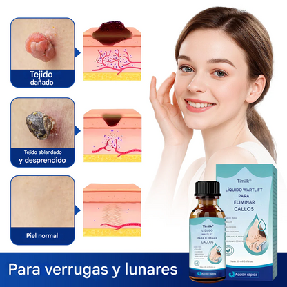 PROMO 2X1 - WartLift® Líquido Para Eliminar Verrugas