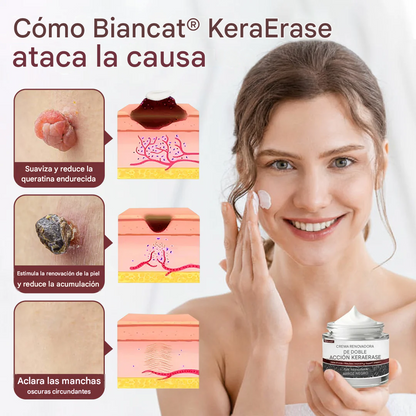 KeraErase ®Crema Eliminadora De Verrugas