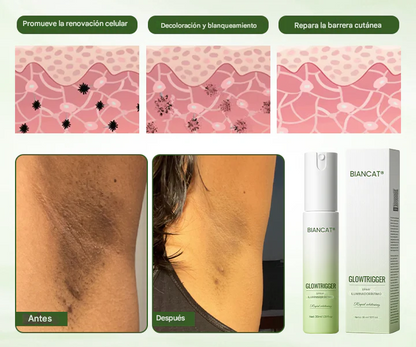 Spray Aclarador De Manchas Negras - GlowTrigger