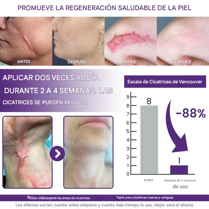 TIMILK® ReGenScar gel reparador de cicatrices (resultados visibles en 7 días)☀️🧴
