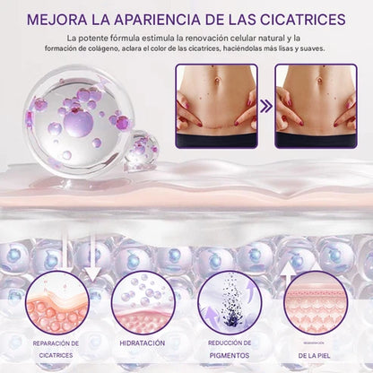 TIMILK® ReGenScar gel reparador de cicatrices (resultados visibles en 7 días)☀️🧴