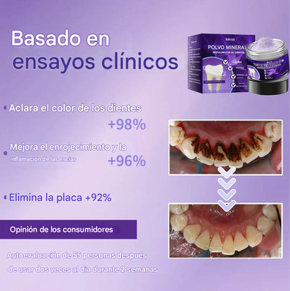 BBOJI™ Polvo mineral para la restauración dental