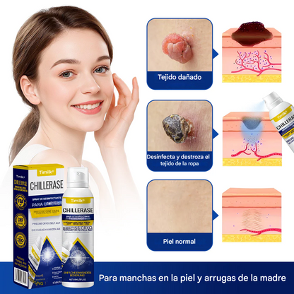 Spray renovador Timilk® ChillErase para imperfecciones